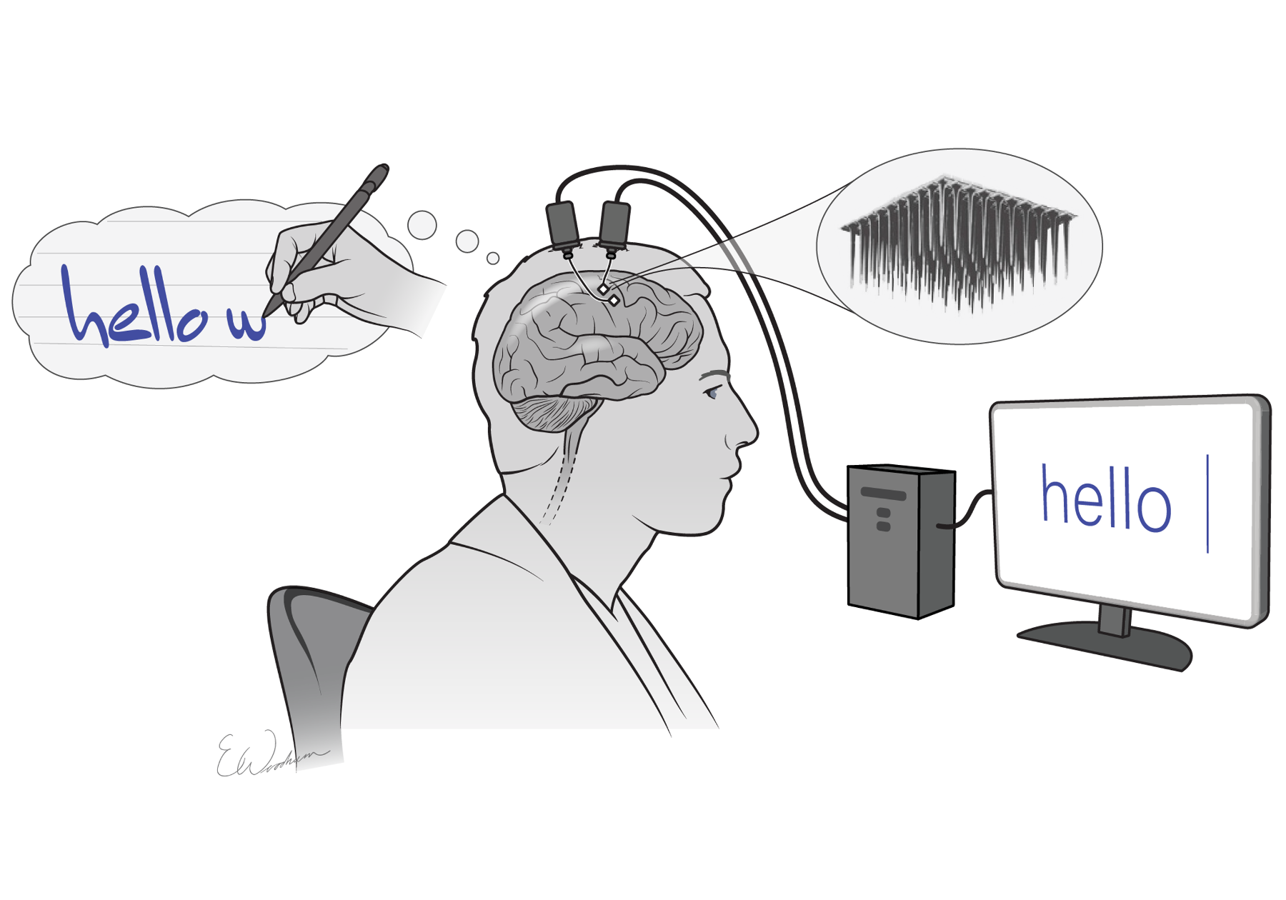 Brain-Computer Interface Technology Illustration