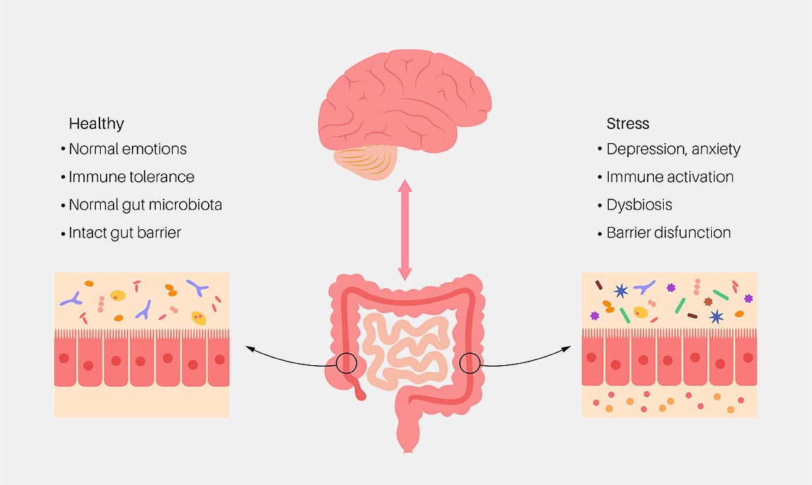 Gut-Brain Axis Graphic